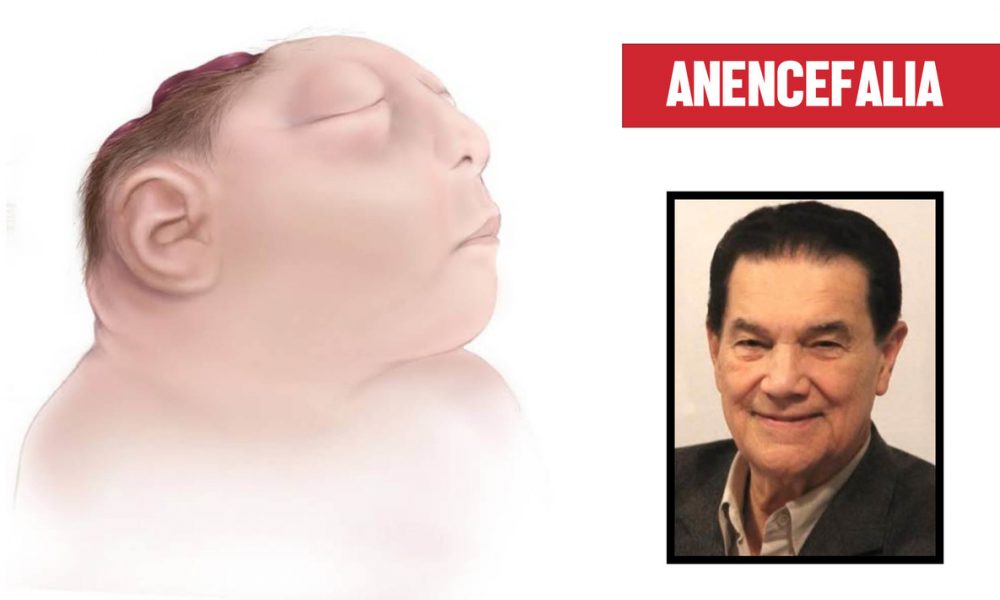 Anencefalia e Divaldo Franco